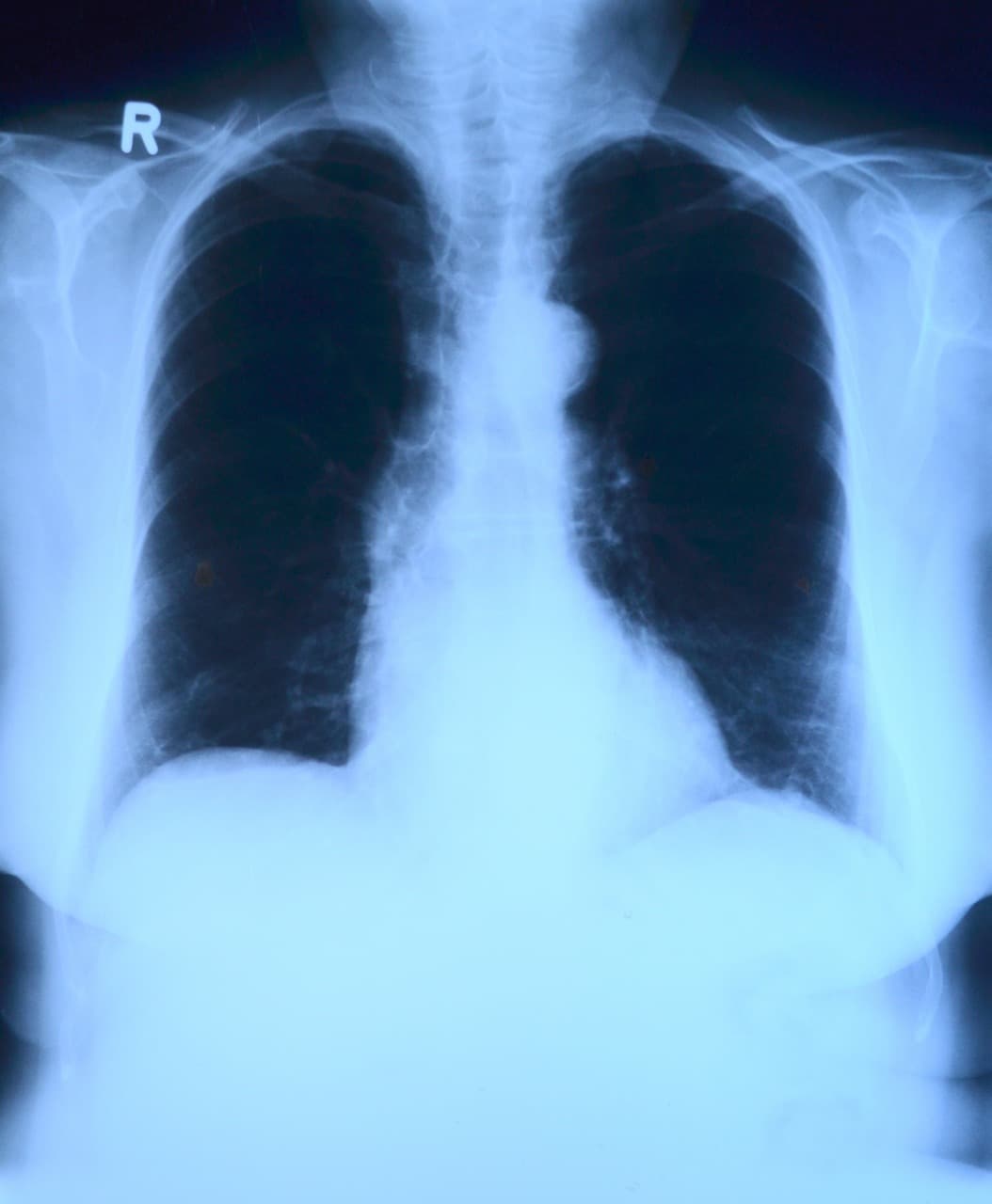AI and 2D Medical Imaging